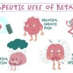 Ketamine: A Rising Star in Mental Health Treatment