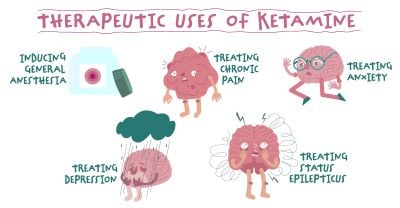 iStock-1916848947-purchased-Ketamine-small.jpg